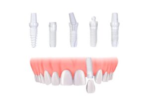 implantes de zirconio