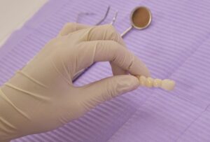 implantes dentales Córdoba